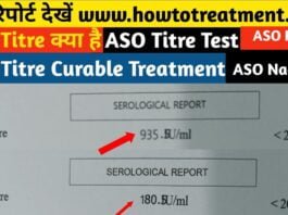 ASO Titer Ayurveda Medicine,ASO titer herbal medicine,aso titer ayurveda treatment, liver treatment,liver medicine,liver ayurveda medicine,liver upchar,liver care,kidney stone treatment,kidney stone upchar,kidney stone ayurvedic ilaj,kidney stone,ayurveda treatment,piles upchar,desi treatment, piles ayurveda cure,piles treatment,my medicine,aso titer 100% ayurvedic medicine,aso titer desi upchar, aso titer ayurveda and herbal treatment,aso titer cure medicine