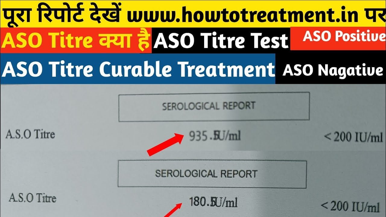 ASO Titer Ayurveda Medicine,ASO titer herbal medicine,aso titer ayurveda treatment, liver treatment,liver medicine,liver ayurveda medicine,liver upchar,liver care,kidney stone treatment,kidney stone upchar,kidney stone ayurvedic ilaj,kidney stone,ayurveda treatment,piles upchar,desi treatment, piles ayurveda cure,piles treatment,my medicine,aso titer 100% ayurvedic medicine,aso titer desi upchar, aso titer ayurveda and herbal treatment,aso titer cure medicine